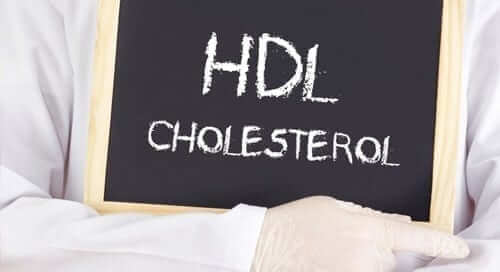 HDL Cholesterol