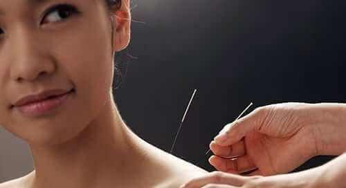 Acupuncture and Diabetes