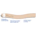 Urocare Catheter/Tubing Strap Standard 9-30 inch thumbnail